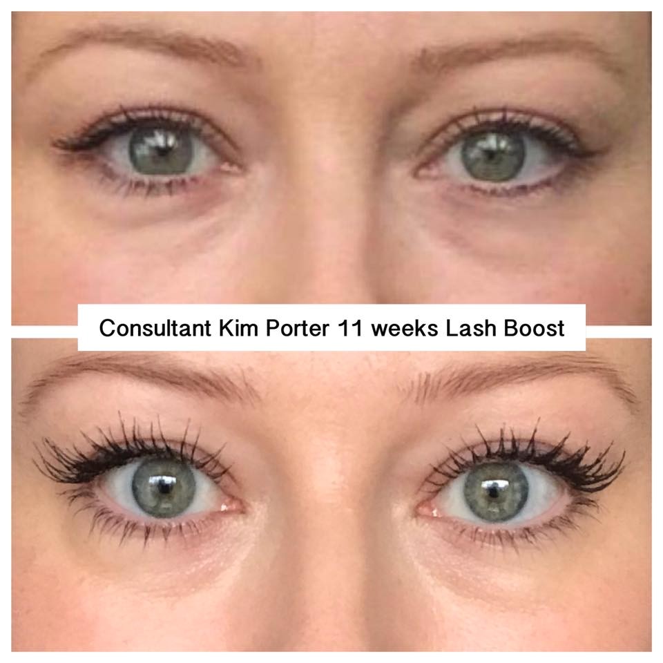 lash boost r8mgmvkvlafnkfz65uot7kxktikb4ofa9wkzoyqyrsu