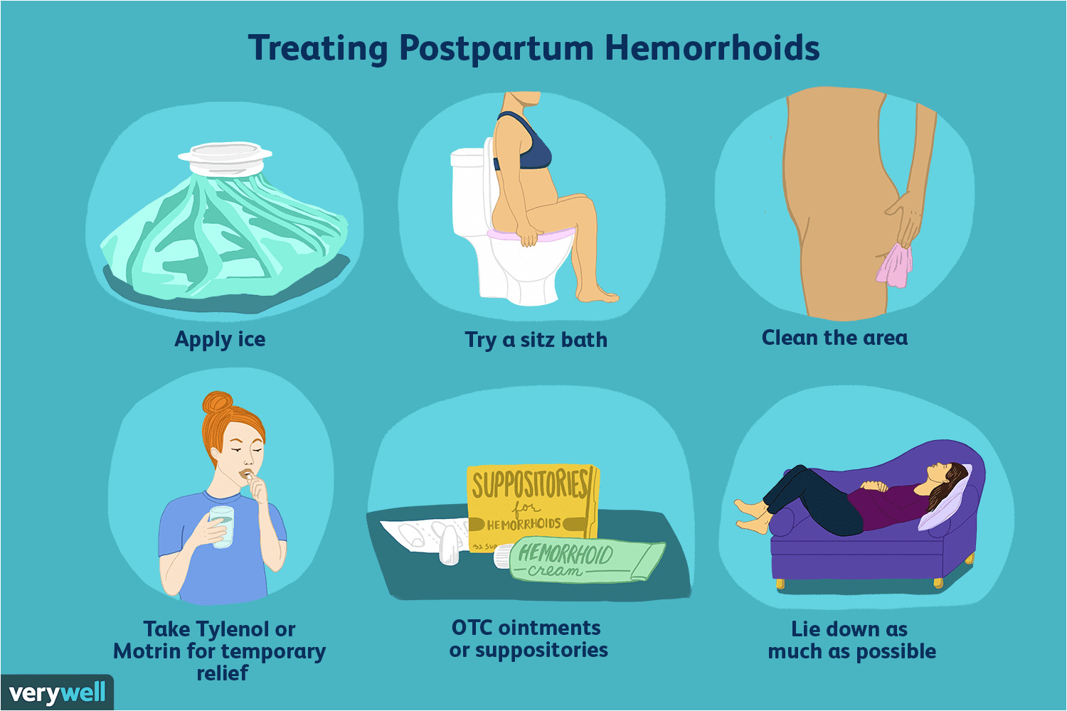 what to do about hemorrhoids after birth