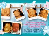 3d Ultrasound Bronx Ny 3d 4d Ultrasound Brooklyn Queens Bronx Staten island