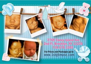 3d Ultrasound Bronx Ny 3d 4d Ultrasound Brooklyn Queens Bronx Staten island