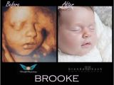 3d Ultrasound Bronx Ny Best 3d Ultrasound In Westchester History Of the Ultrasound