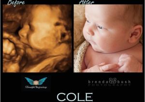 3d Ultrasound Bronx Ny Best 3d Ultrasound In Westchester History Of the Ultrasound