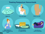 Best Pads for Bleeding after Delivery Hemorrhoids after Giving Birth at Home Treatments