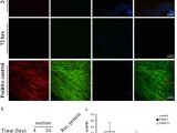 Chapman Heating and Cooling Columbia Mo Distinct Biological events Generated by Ecm Proteolysis by Two