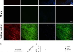 Chapman Heating and Cooling Columbia Mo Distinct Biological events Generated by Ecm Proteolysis by Two