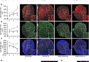 Download Belgium Vs Mexico Highlights A Dgki Foxo Ubiquitin Proteolytic Axis Controls Fiber Size During