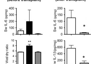 Ez Breathe Ventilation System Model 400 Functional Repair Of Human Donor Lungs by Il 10 Gene therapy