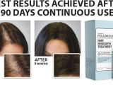 Follinique Hair Growth Reviews Follinique Reviews Advance Minoxidil Fda Approve Hair