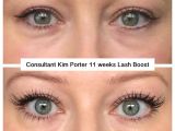 Latisse Vs Rodan and Fields Lash Boost Lash Boost Pictures to Pin On Pinterest thepinsta