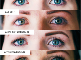 Latisse Vs Rodan and Fields Lash Boost Lash Boost Pictures to Pin On Pinterest thepinsta