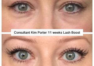 Latisse Vs Rodan and Fields Lash Boost Lash Boost Pictures to Pin On Pinterest thepinsta