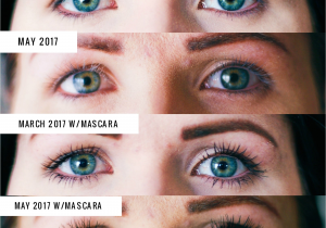 Latisse Vs Rodan and Fields Lash Boost Lash Boost Pictures to Pin On Pinterest thepinsta