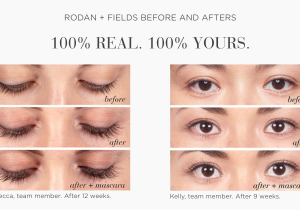 Latisse Vs Rodan and Fields Lash Boost Longer Fuller Lashes Yes Please Gbo Fashion