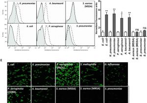 Tic Tac toe toilet Paper Holder Plans In Situ Identification Of Gram Negative Bacteria In Human Lungs