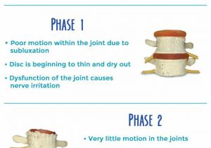 Wobble Chair for Spondylolisthesis 344 Best Exercise Back Images On Pinterest Excercise Exercise